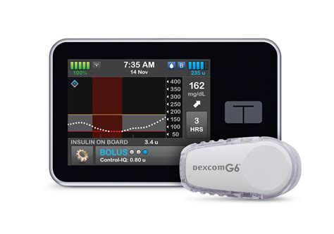 celine pomp insuline|t slim insulin pump.